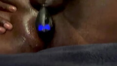 Acmejoy prostate massage Thumb